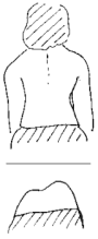 Scoliosis scan